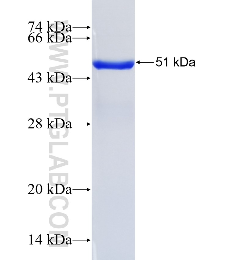 p65; RELA fusion protein Ag1199 SDS-PAGE
