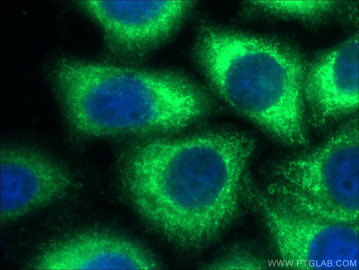 IF Staining of HepG2 using 10745-1-AP