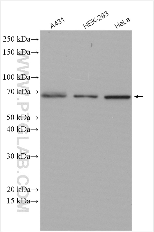 WB analysis using 10745-1-AP