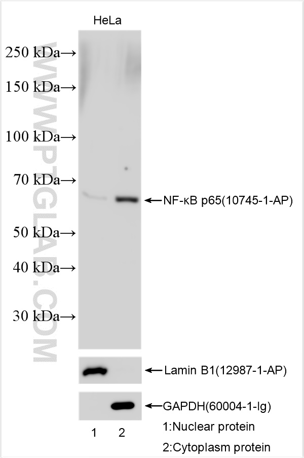 WB analysis using 10745-1-AP