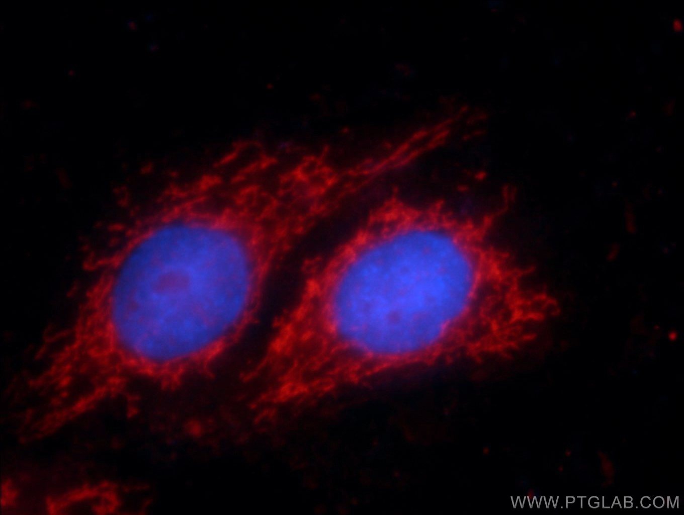 IF Staining of HepG2 using 14485-1-AP