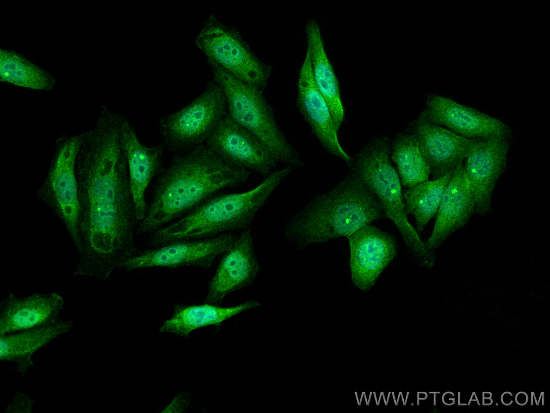 IF Staining of HepG2 using 14485-1-AP