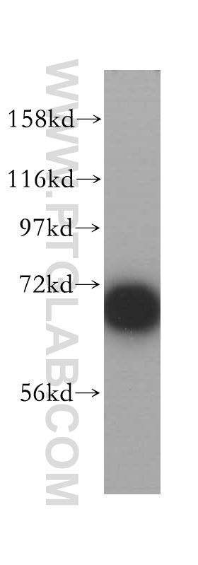 p70(S6K) Polyclonal antibody