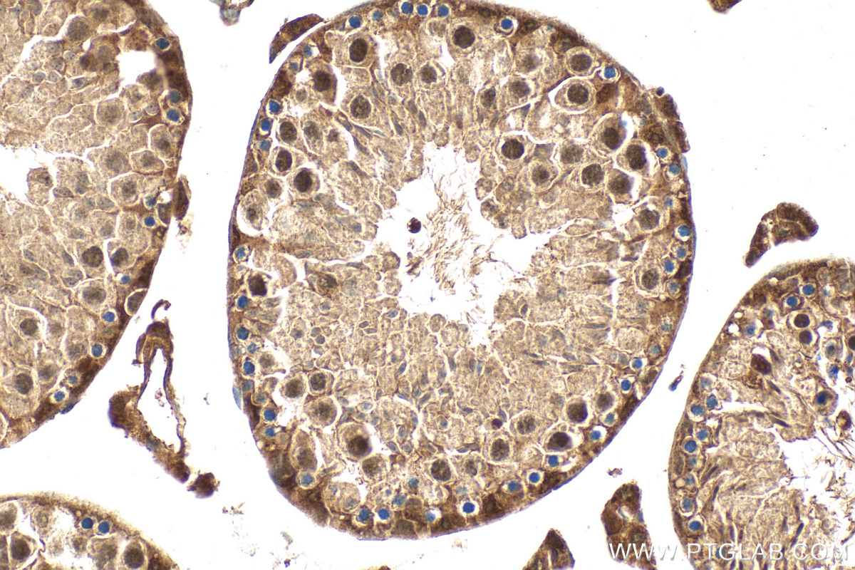 IHC staining of mouse testis using 27809-1-AP IHC staining of mouse testis using 27809-1-AP