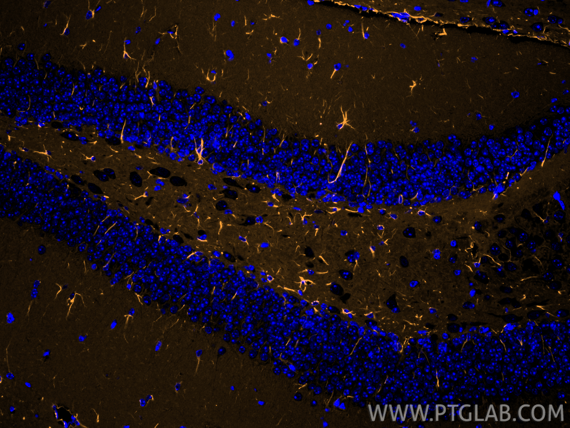 IF Staining of mouse brain using CL555-60309
