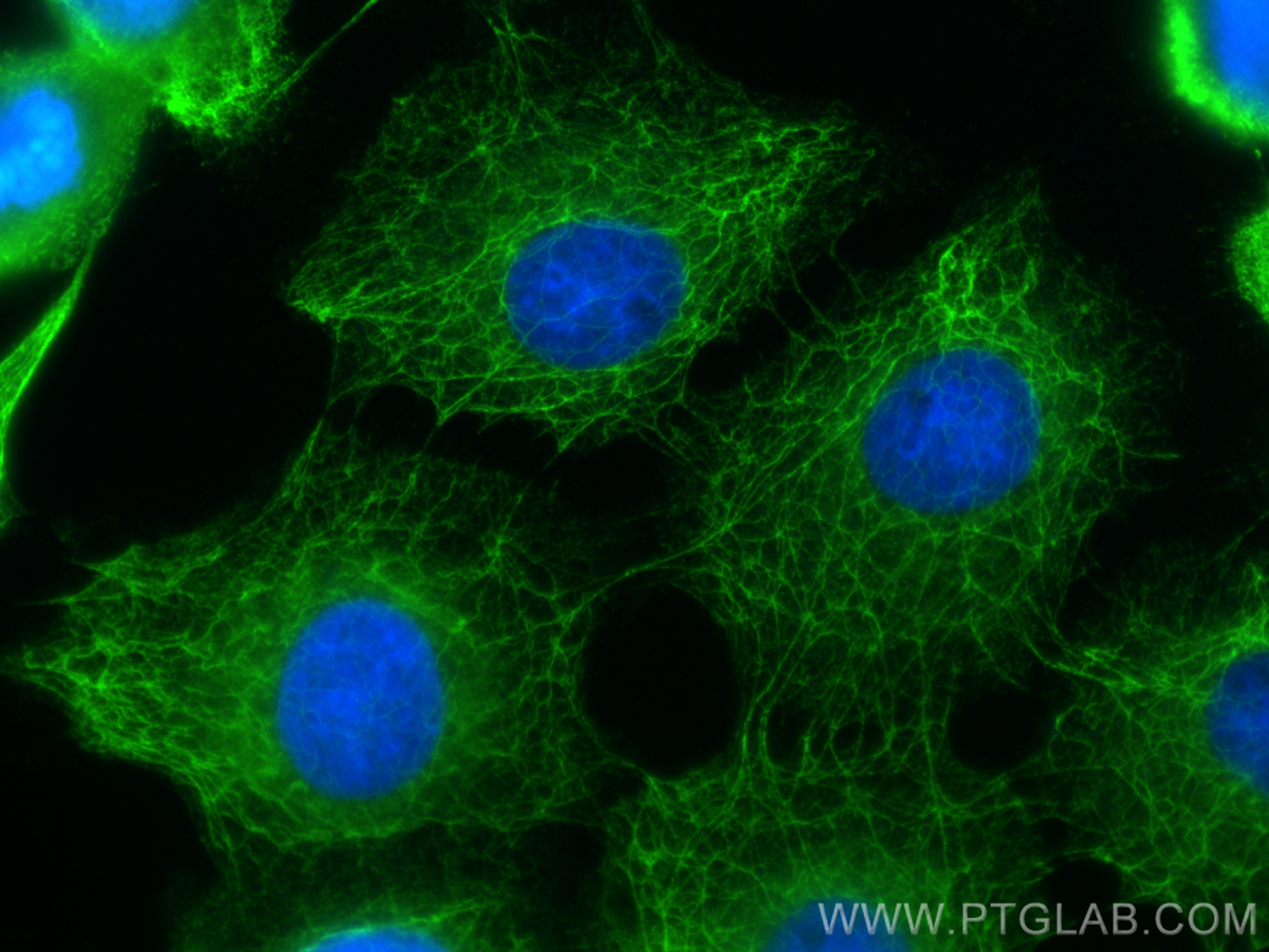 IF Staining of A431 using 26411-1-AP