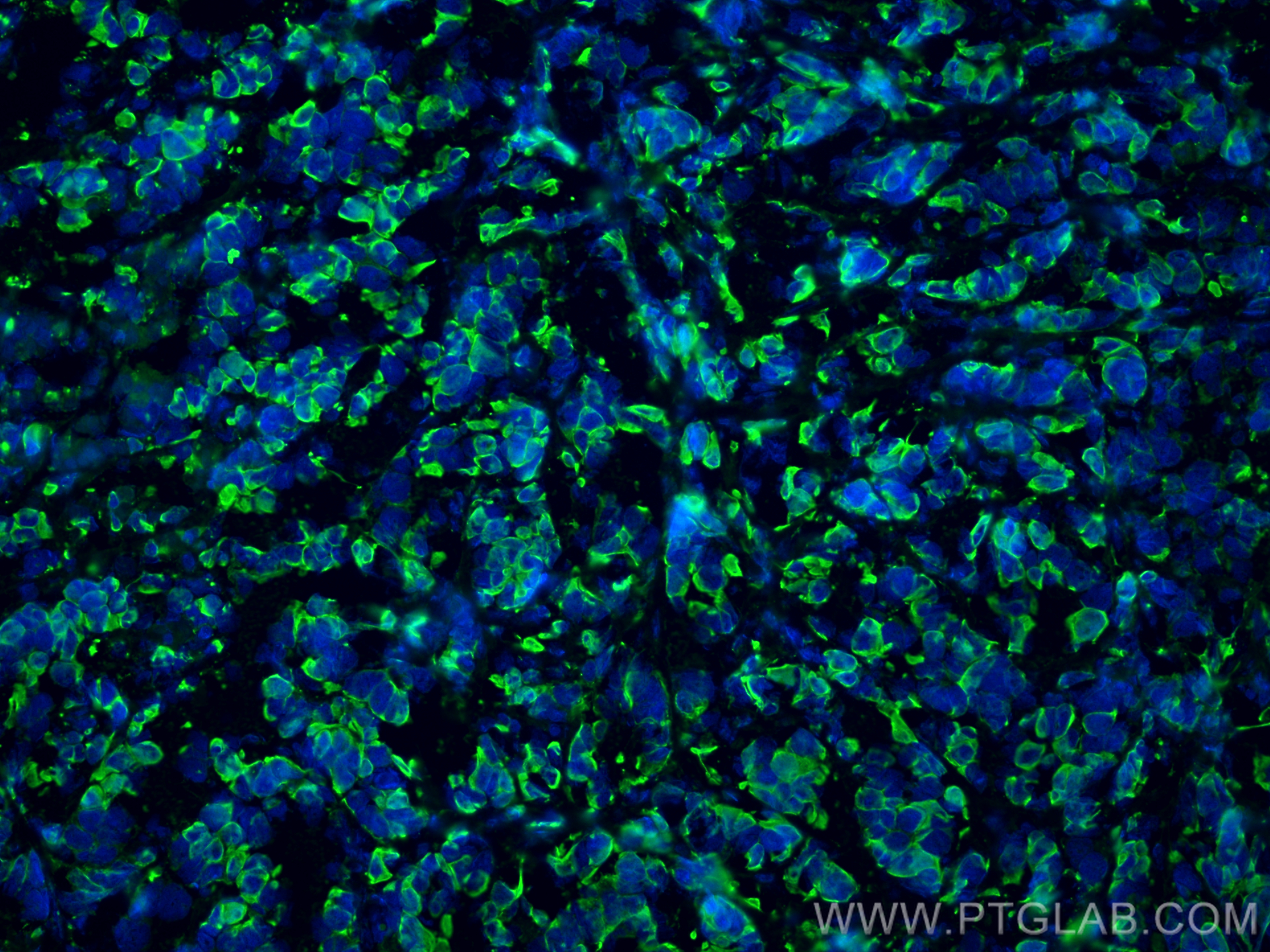 IF Staining of mouse breast cancer using 26411-1-AP