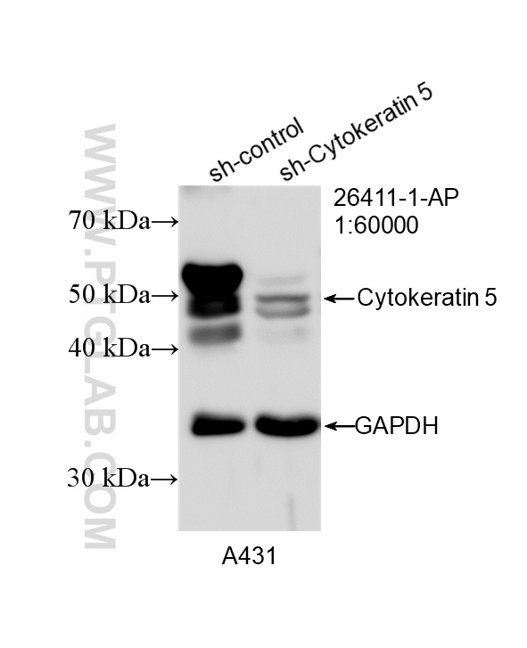 WB analysis of A431 using 26411-1-AP