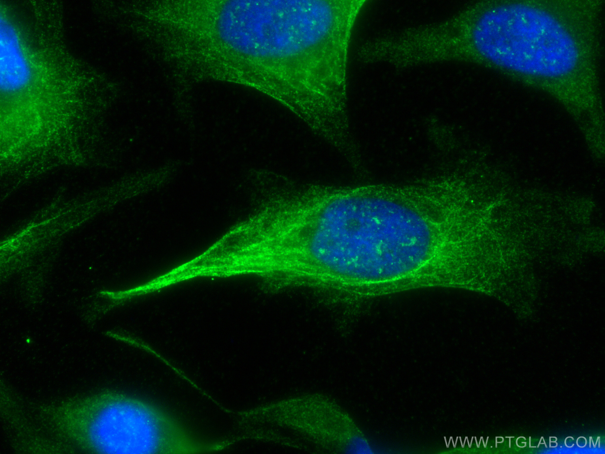 Immunofluorescent analysis of (-20°C Methanol) fixed HeLa cells using KRT5 antibody (82548-3-RR, Clone: 7J23 ) at dilution of 1:400 and CoraLite®488-Conjugated Goat Anti-Rabbit IgG(H+L). IF Staining of HeLa using 82548-3-RR
