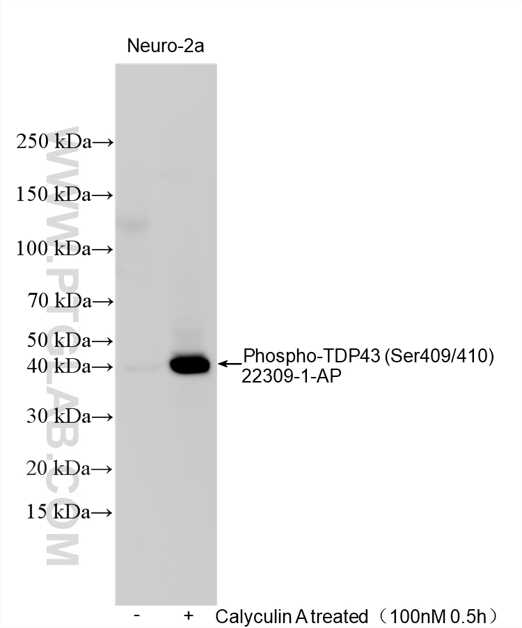 WB analysis using 22309-1-AP WB analysis using 22309-1-AP