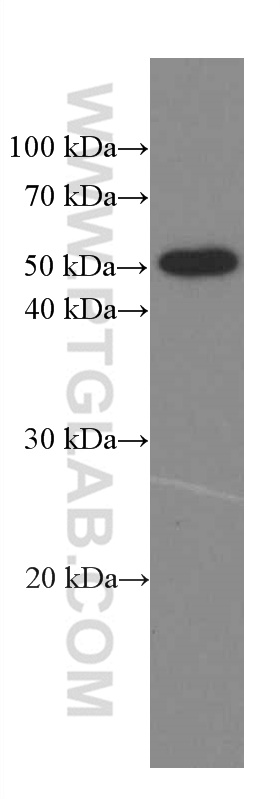 Phospho-TDP43 (Ser409/410)