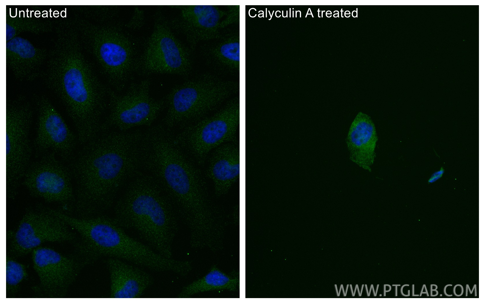 IF Staining of HeLa using 80007-1-RR