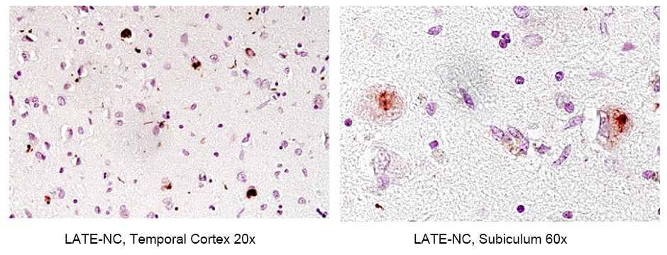 IHC staining of human brain using 80007-1-RR (same clone as 80007-1-PBS)
