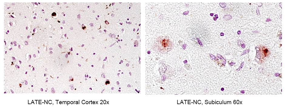 IHC staining of human brain using 80007-1-RR