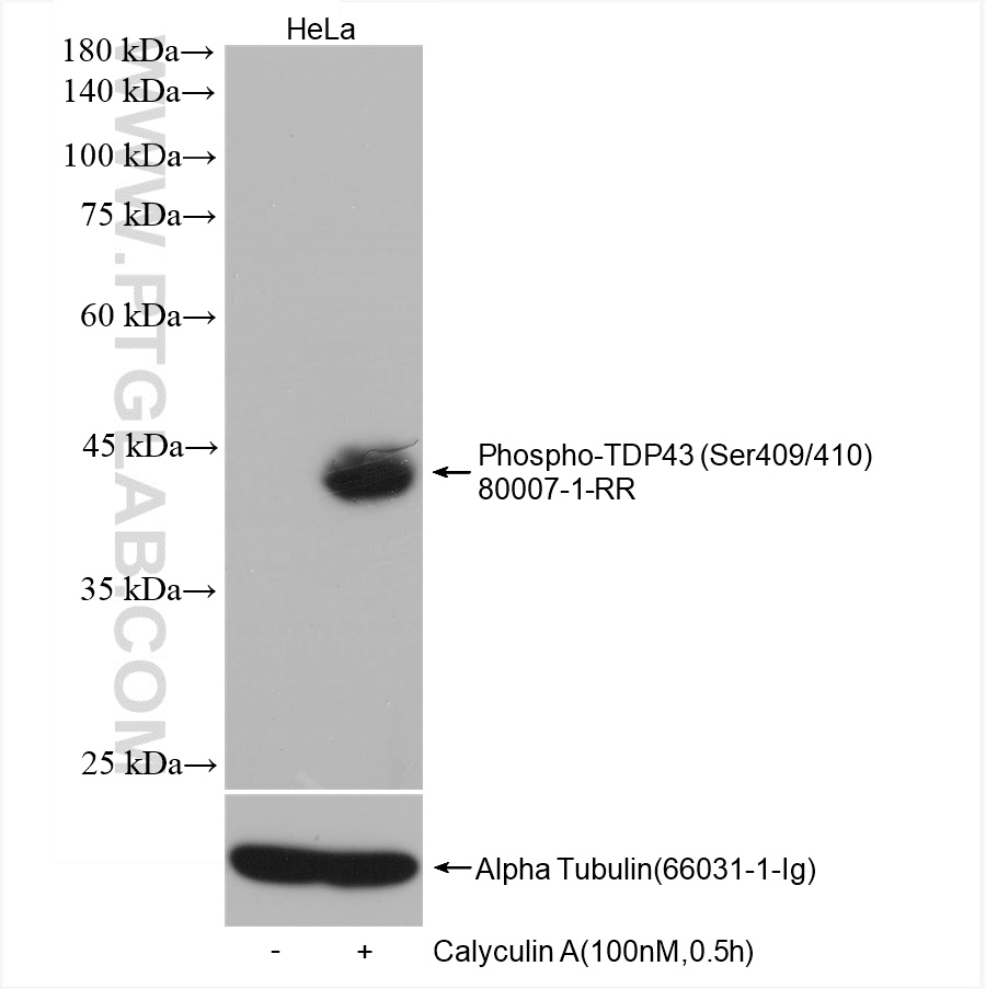 WB analysis of HeLa using 80007-1-RR (same clone as 80007-1-PBS)