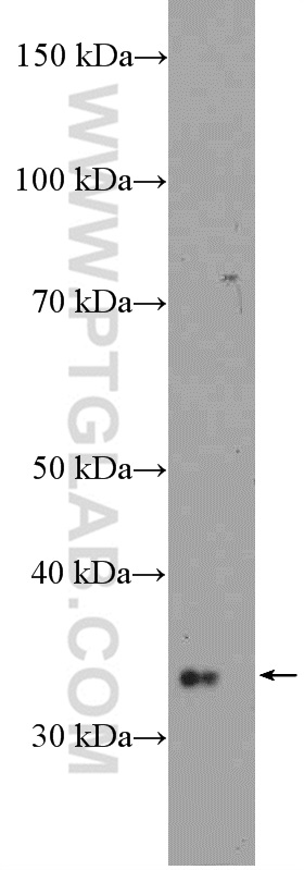 WB analysis of HeLa using 10018-3-AP