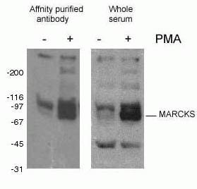 WB analysis of Mouse J774 Macrophage cells using 10018-3-AP