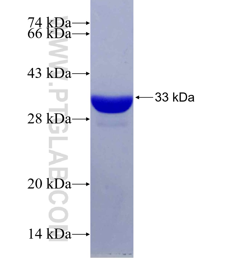 pou4f2 fusion protein Ag29432 SDS-PAGE pou4f2 fusion protein Ag29432 SDS-PAGE