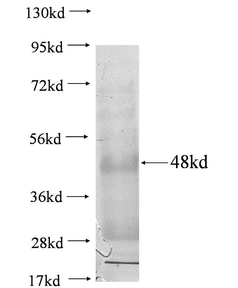 ppa2 fusion protein Ag0750 SDS-PAGE ppa2 fusion protein Ag0750 SDS-PAGE