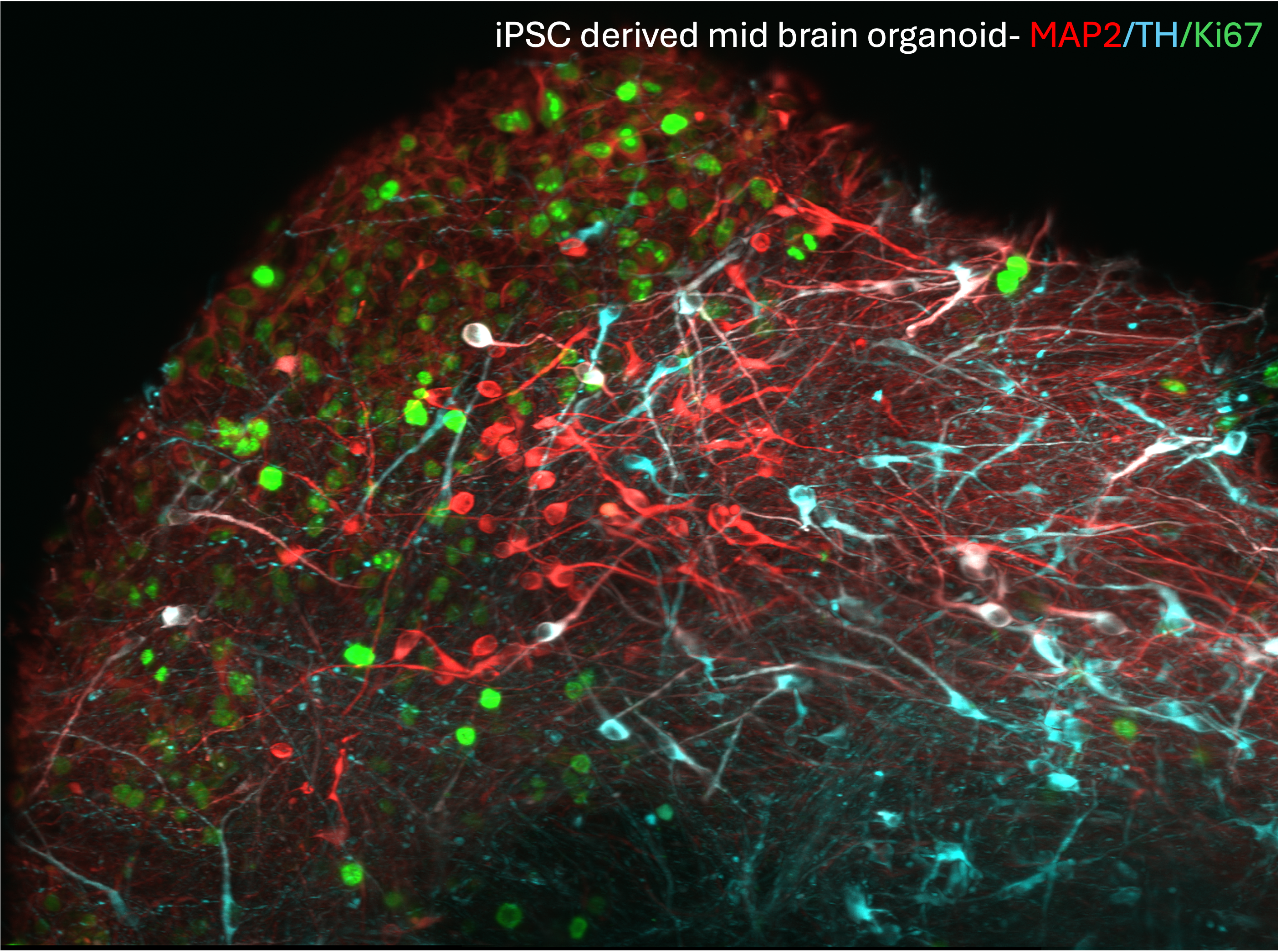 iPSC-derived Human Midbrain Organoids Cultured using Recombinant Human Noggin, Sonic Hedgehog (SHH), FGF-8B, GDNF and BDNF). iPSCs differentiated to Midbrain organoids using HumanKine® recombinant human Noggin (HZ-1118), HumanKine® recombinant human SHH (HZ-1306), HumanKine® recombinant human FGF-8b (HZ-1103), HumanKine® recombinant human GDNF ( HZ-1311), HumanKine® recombinant human BDNF ( HZ-1335) were fixed and permeabilized for detection of endogenous MAP2 (red), Ki67(green) and Tyrosine hydroxylase(Cyan) using primary antibodies labelled using FlexAble antibody labeling kits( KFA502- FlexAble 2.0 CoraLite® Plus 555 Antibody Labeling Kit for Rabbit IgG, FlexAble 2.0 CoraLite® Plus 647 Antibody Labeling Kit for Rabbit IgG and FlexAble 2.0 CoraLite® Plus 488 Antibody Labeling Kit for Rabbit IgG)