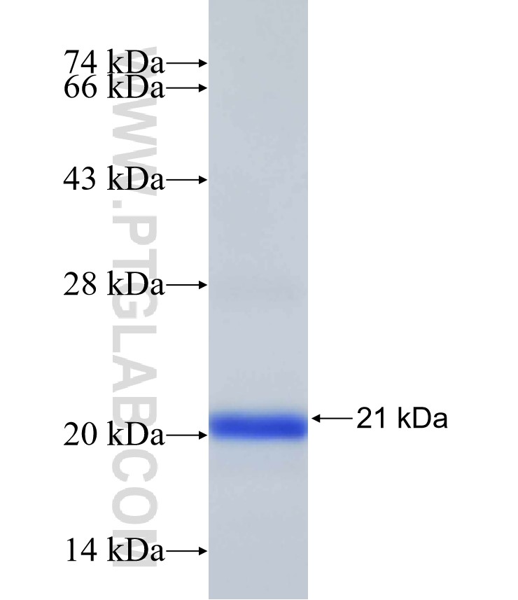 rpeB fusion protein Ag31848 SDS-PAGE