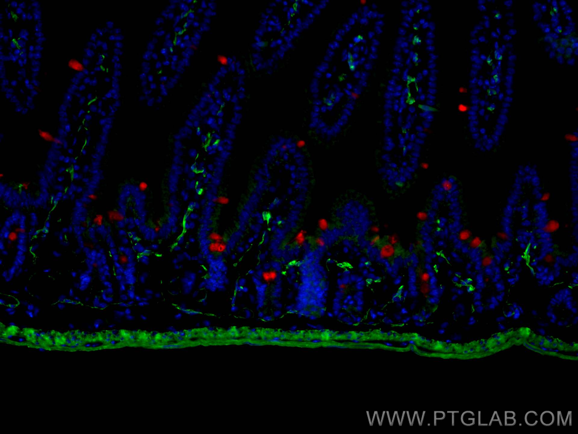 smooth muscle actin