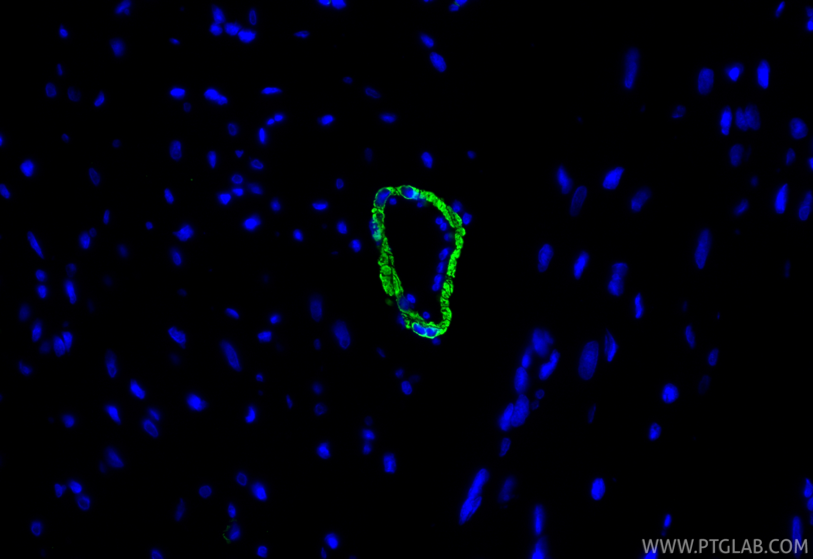 IF Staining of rat heart using 67735-1-Ig IF Staining of rat heart using 67735-1-Ig