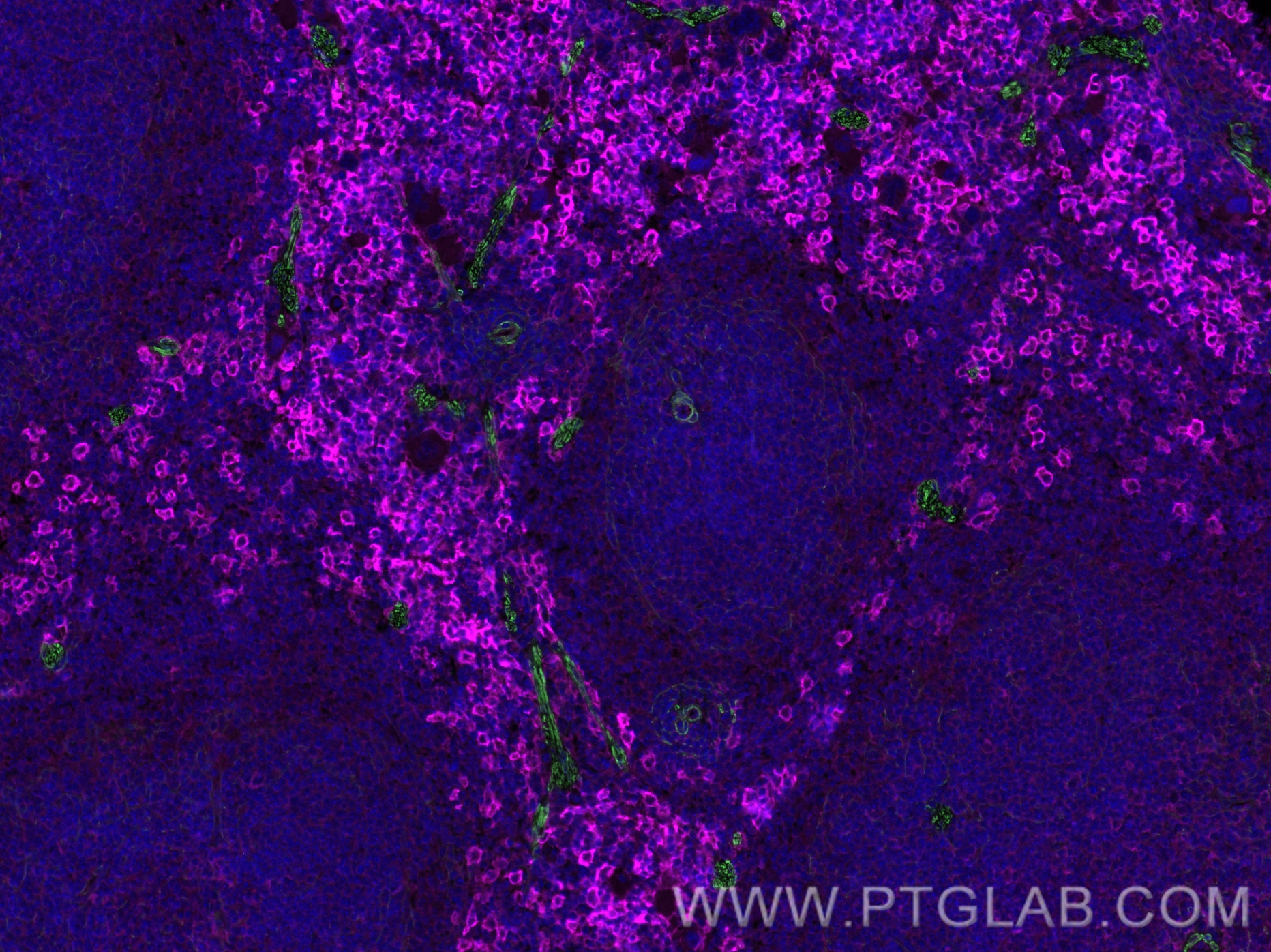 IF Staining of mouse spleen using CL488-55135