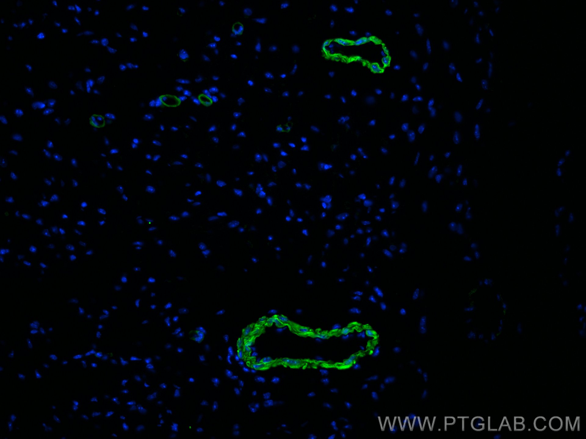 IF Staining of mouse heart using CL488-67735