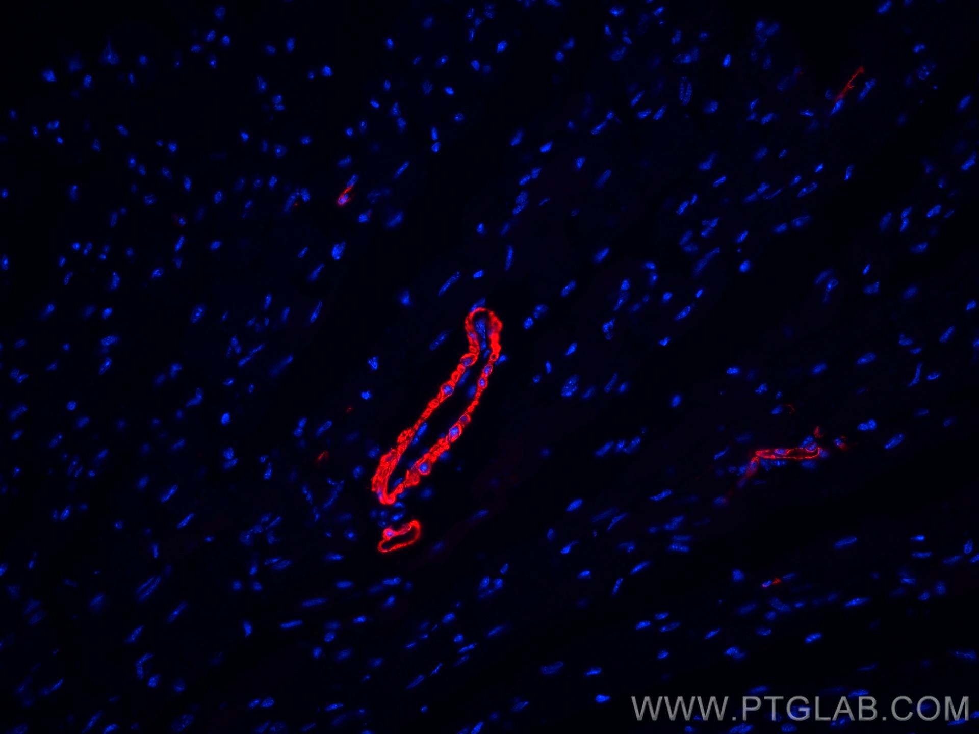 smooth muscle actin specific