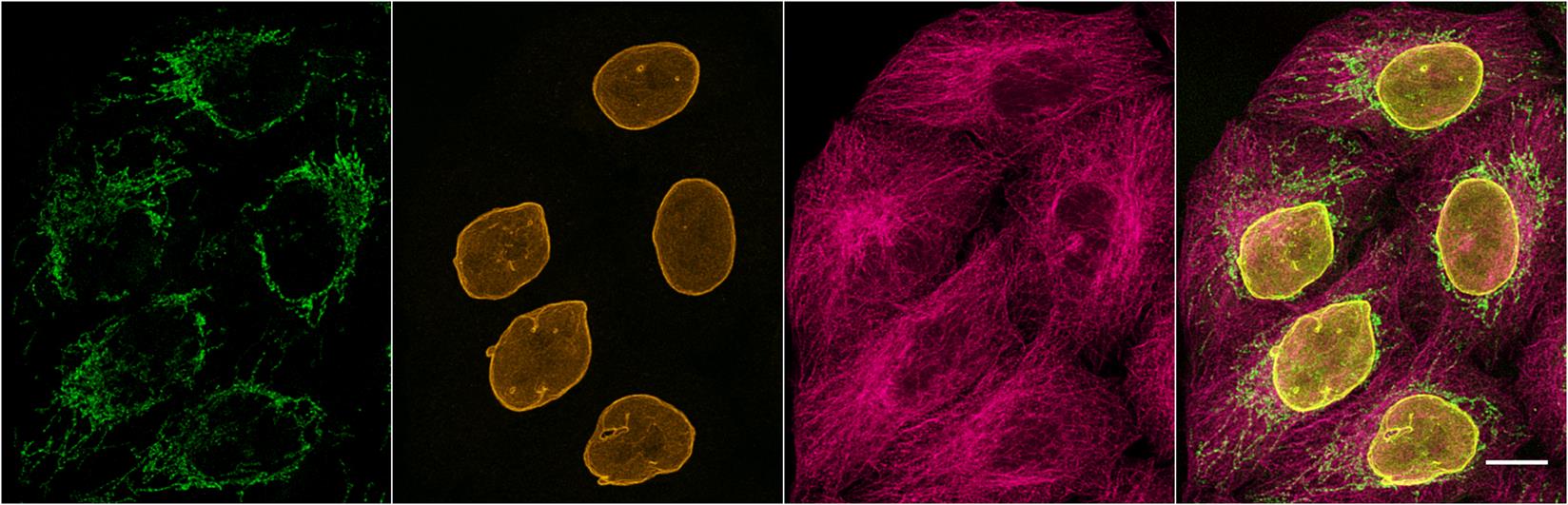 HeLa cells were immunostained with mouse IgG2b anti-βTubulin antibody + alpaca anti-mouse IgG2b VHH Alexa Fluor® 568 (red). Nuclei were stained with DAPI (blue). Scale bar, 10 μm. Images were recorded at the Core Facility Bioimaging at the Biomedical Center, LMU Munich