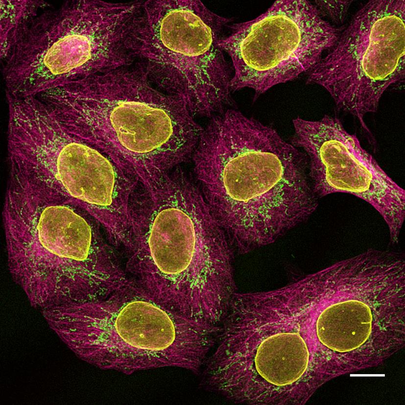 Multiplexed immunostaining of HeLa cells with two alpaca anti-mouse Nano-Secondaries and one anti-rabbit Nano-Secondary. Green: mouse IgG1 anti-COX4 + alpaca anti-mouse IgG1 VHH Alexa Fluor® 488. Magenta: mouse IgG2b anti-Tubulin + alpaca anti-mouse IgG2b VHH Alexa Fluor® 647. Yellow: rabbit anti-Lamin + alpaca anti-rabbit IgG VHH Alexa Fluor® 568. Scale bar, 10 μm. Images were recorded at the Core Facility Bioimaging at the Biomedical Center, LMU Munich.