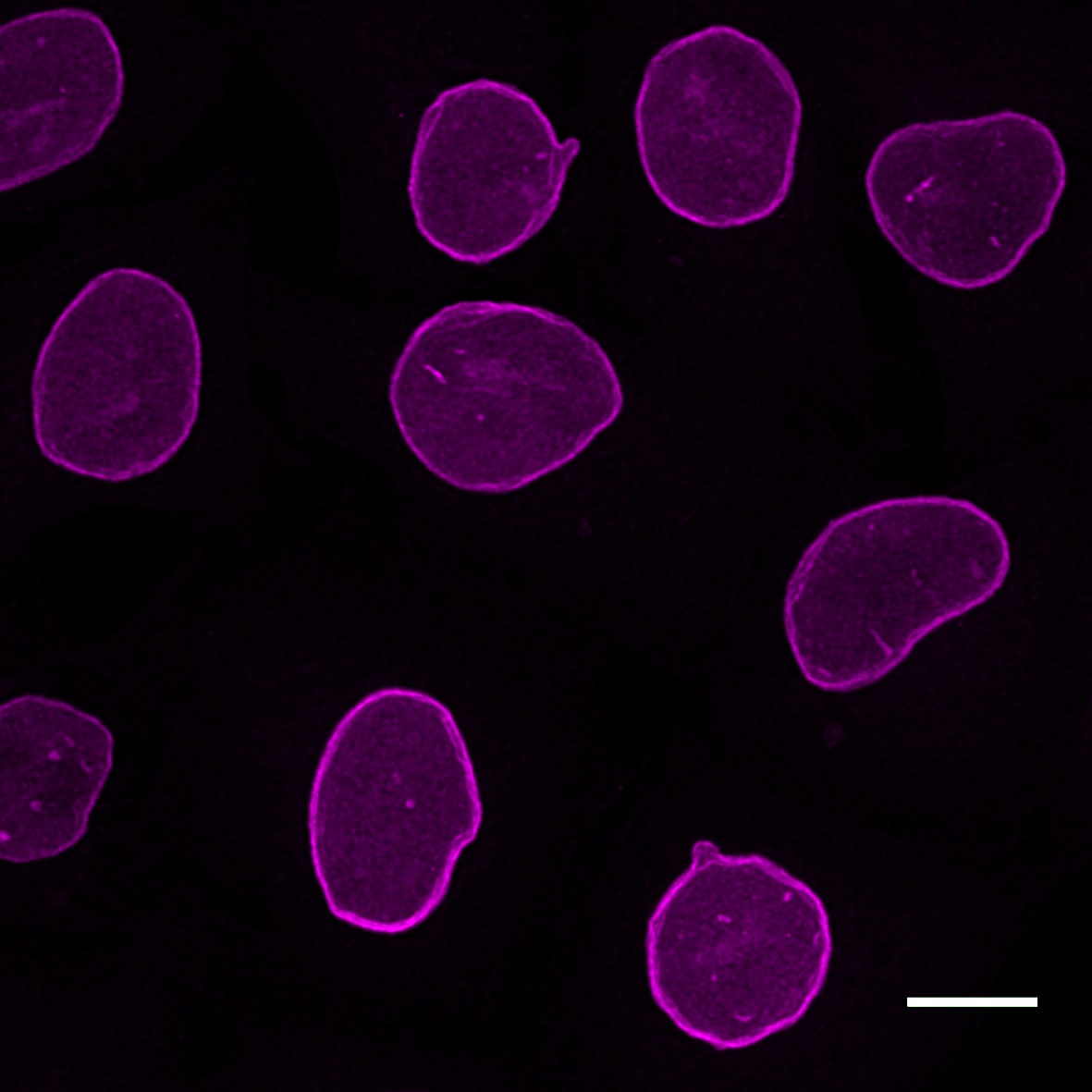 HeLa cells were immunostained with mouse IgG3 anti-Lamin A/C antibody + alpaca anti-mouse IgG3 VHH Alexa Fluor® 647 (magenta). Scale bar, 10 μm. Images were recorded at the Core Facility Bioimaging at the Biomedical Center, LMU Munich.