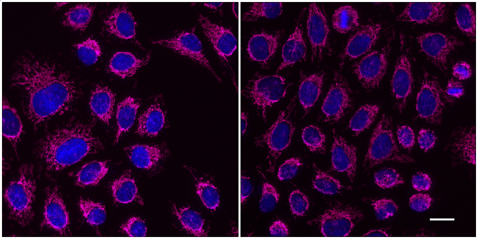 One-step staining (left) vs. sequential staining (right) of HeLa cells with anti-MOT (mitochondria) mouse IgG3 monoclonal primary antibody + alpaca anti-mouse IgG3 VHH Alexa Fluor® 647 (magenta). Cell nuclei are stained with DAPI (blue). Scale bar, 20 μm.