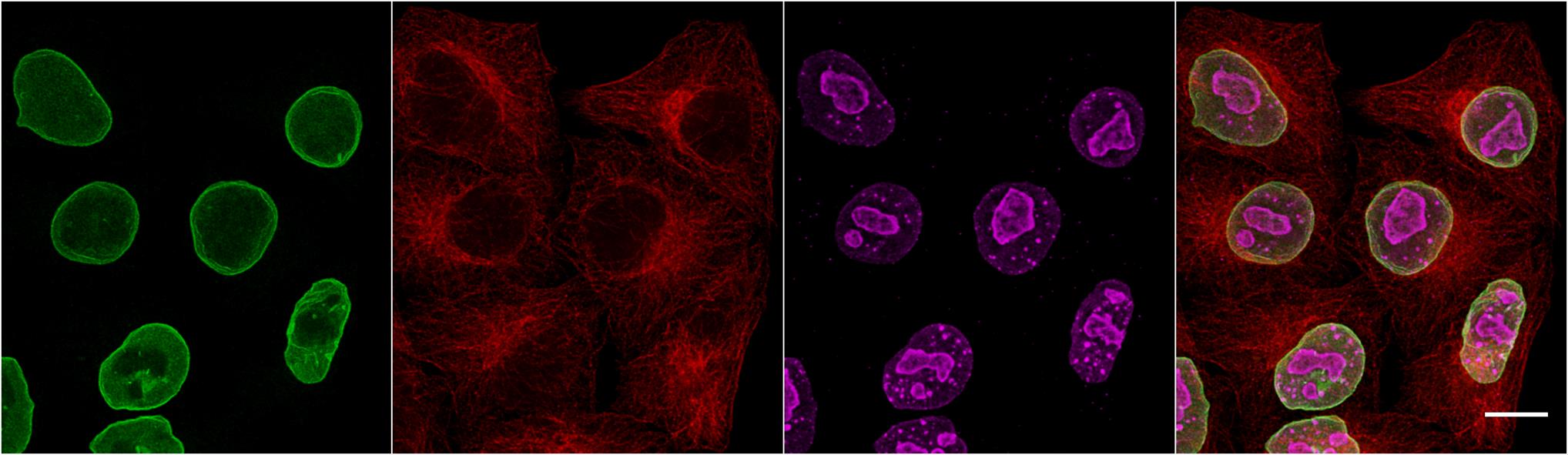 Multiplexed immunostaining of HeLa cells with two alpaca anti-mouse Nano-Secondaries and one conventional secondary antibody. Green: mouse IgG3 anti-Lamin + alpaca anti-mouse IgG3 VHH Alexa Fluor® 488. Red: mouse IgG1 anti-Tubulin + alpaca anti-mouse gG1 VHH Alexa Fluor® 568. Magenta: rabbit anti-Ki67 + conventional polyclonal secondary anti-rabbit-AF647. Scale bar, 10 μm. Images were recorded at the Core Facility Bioimaging at the Biomedical Center, LMU Munich.