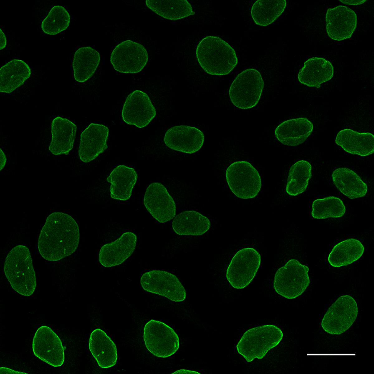 Alpaca anti-rabbit IgG VHH Alexa Fluor® 488 was applied in conjunction with rabbit anti-Lamin B1 antibodies for immunostaining of nuclear lamina (green) in HeLa cells. Scale bar, 20 μm. Images were recorded at the Core Facility Bioimaging at the Biomedical Center, LMU Munich.