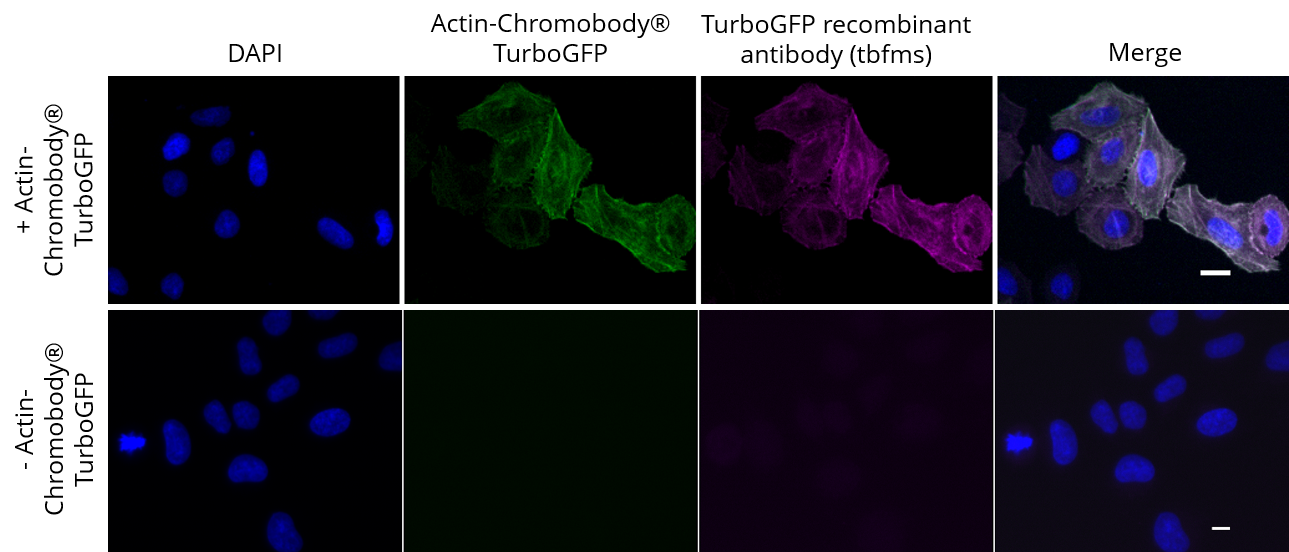 HeLa cells transiently expressing Actin-Chromobody?-TurboGFP were immunostained with TurboGFP recombinant antibody, VHH-mouse IgG1 Fc fusion [CTK0204] (tbfms, 1:400) and Nano-Secondary? alpaca anti-mouse IgG1, recombinant VHH, Alexa Fluor? 647 [CTK0103, CTK0104] (sms1AF647-1, 1:500). Scale bar, 10 μM