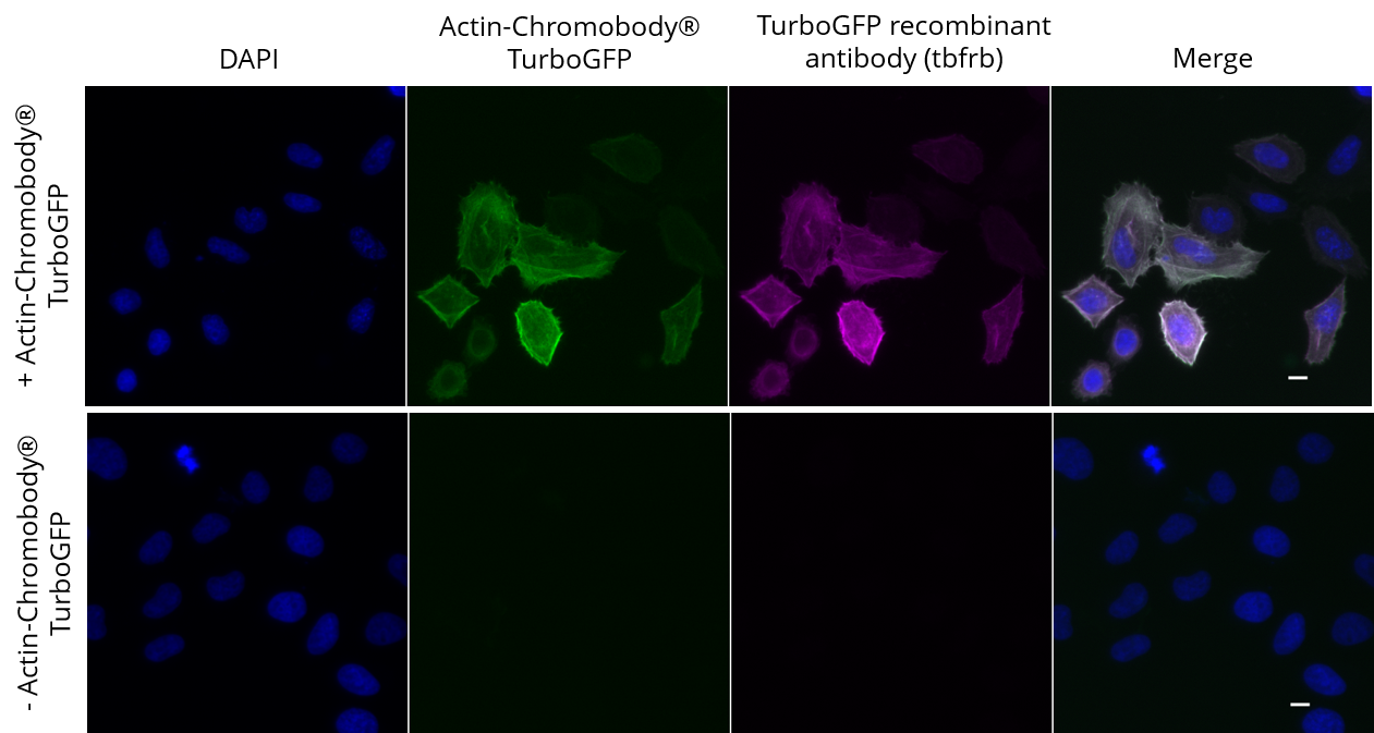 HeLa cells transiently expressing Actin-Chromobody?-TurboGFP were immunostained with TurboGFP recombinant antibody, VHH-rabbit IgG Fc fusion [CTK0204] (tbfrb-20, 1:1,000) and Nano-Secondary? alpaca anti-human IgG/anti-rabbit IgG, recombinant VHH, Alexa Fluor? 647 [CTK0101, CTK0102] (srbAF647-1, 1:1,000). Scale bar, 10 μM.