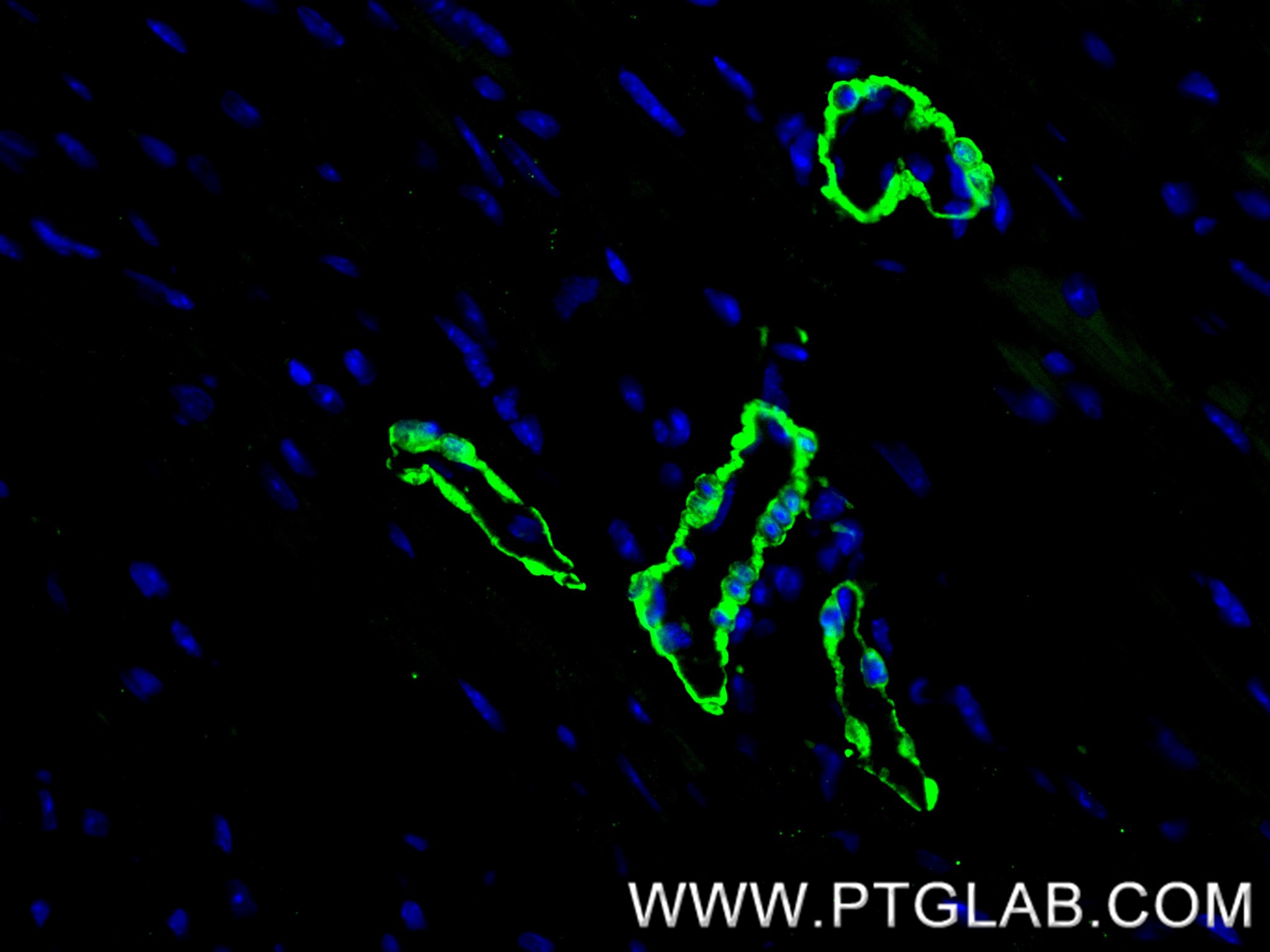 IF Staining of mouse heart using 83922-2-RR (same clone as 83922-2-PBS)