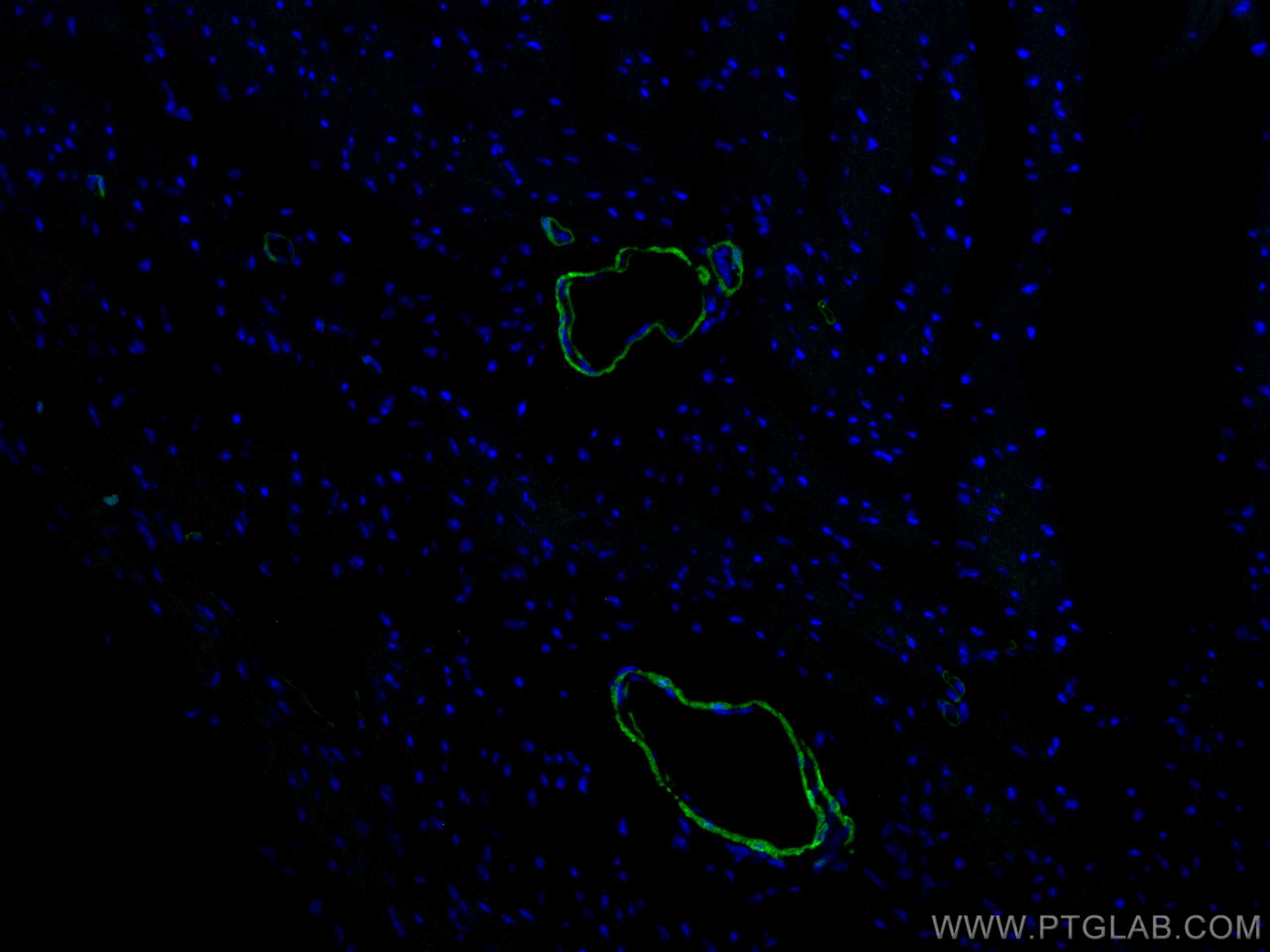 transgelin/SM22