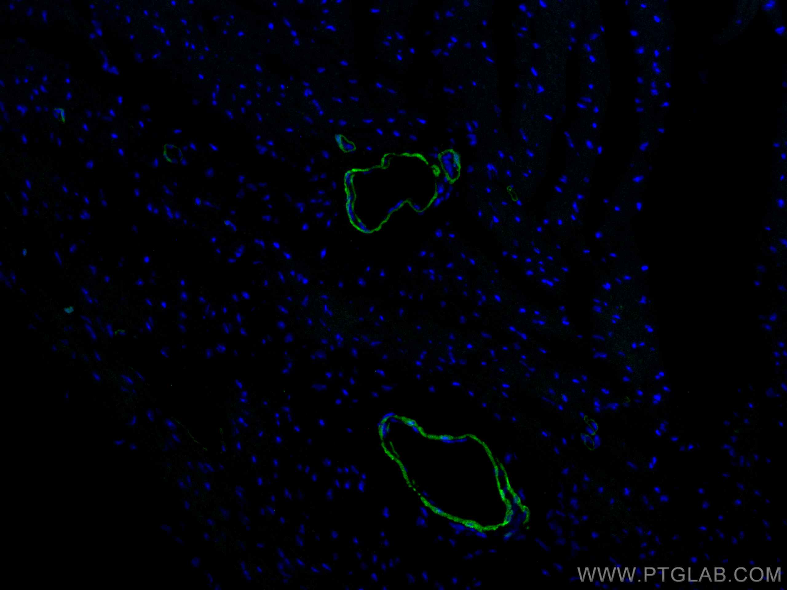 transgelin/SM22