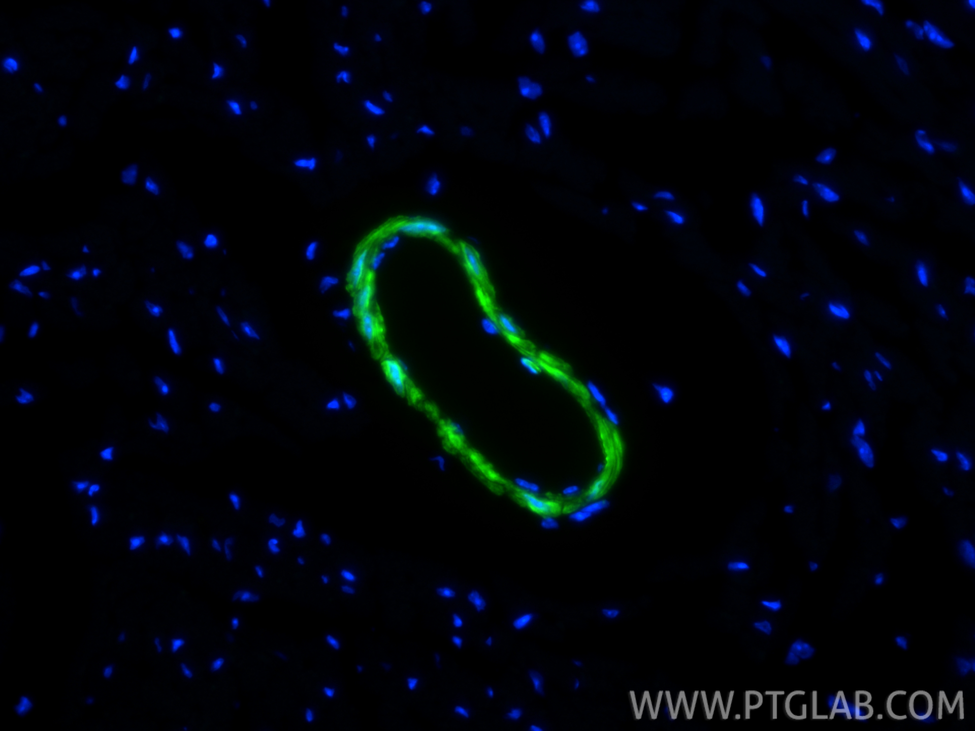 IF Staining of mouse heart using CL488-83922-2