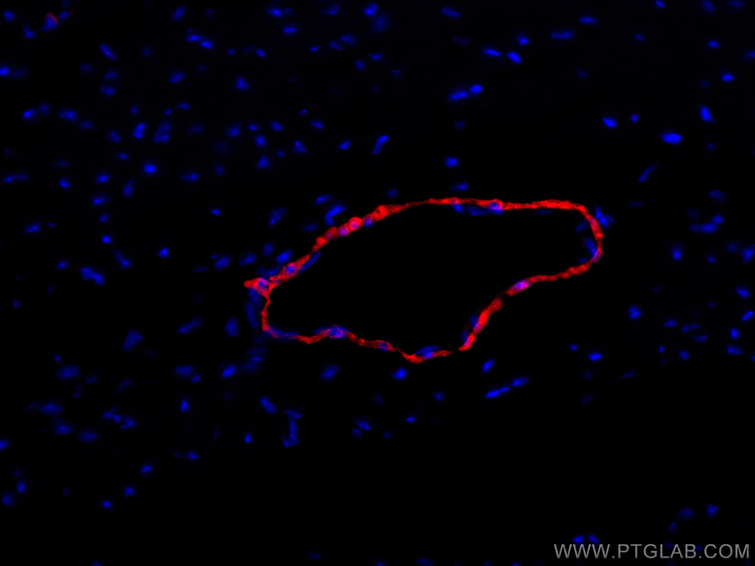 transgelin/SM22