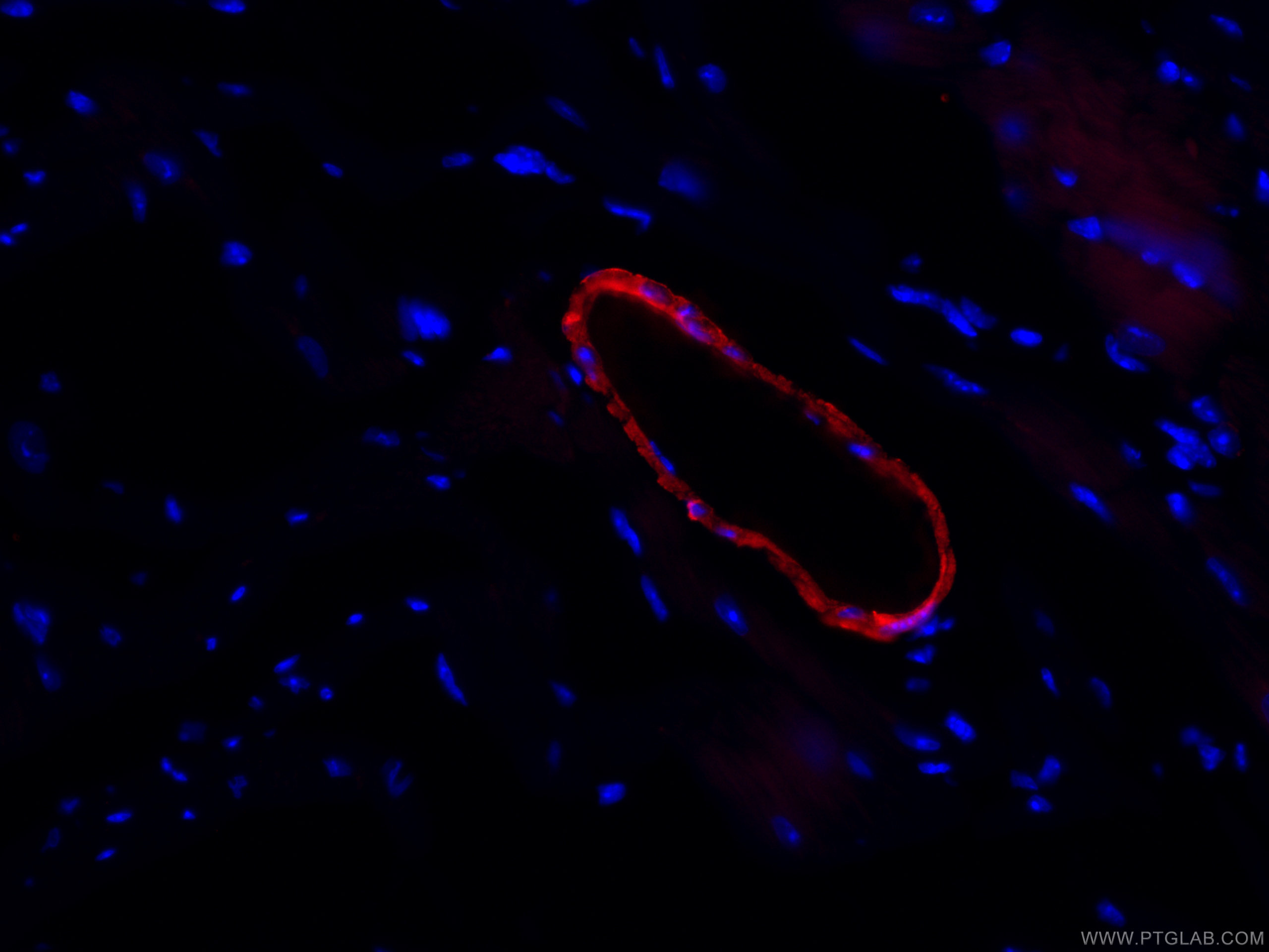 IF Staining of mouse heart using CL594-60213