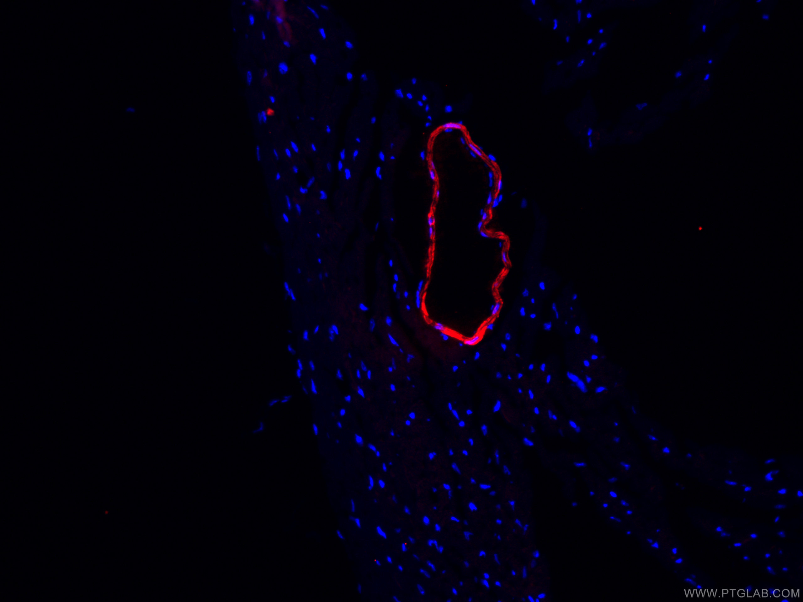 transgelin/SM22