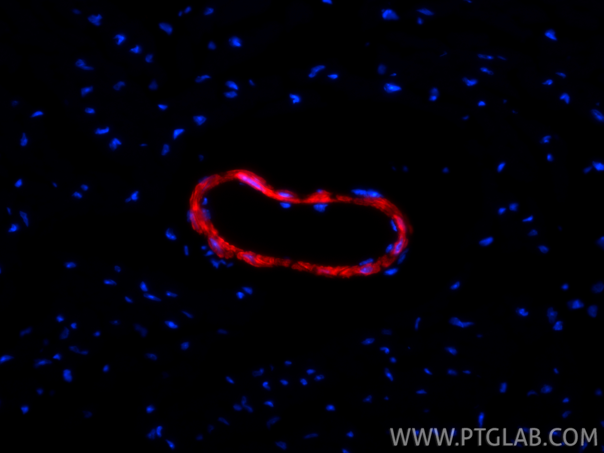 IF Staining of mouse heart using CL594-83922-2