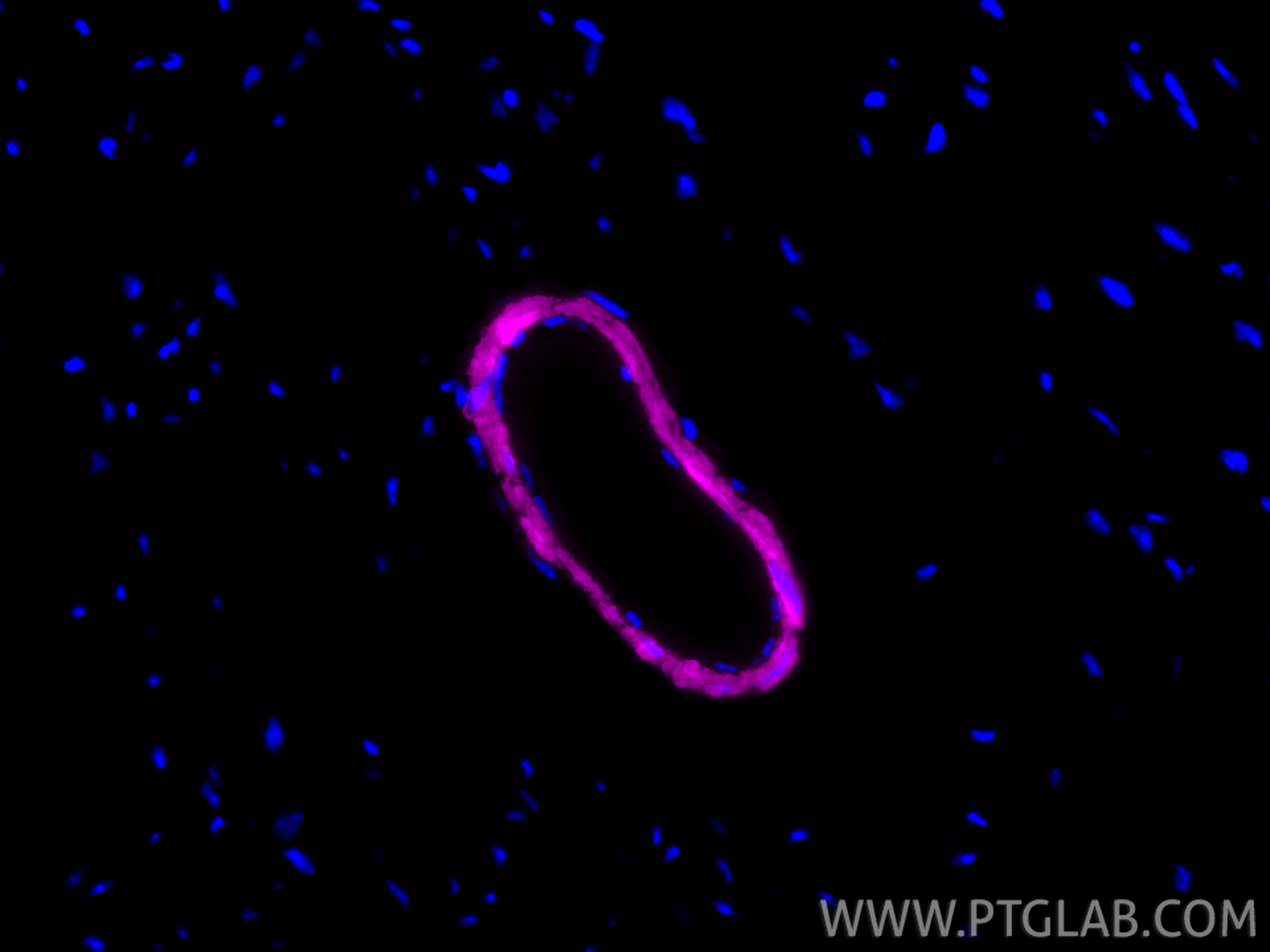 IF Staining of mouse heart using CL647-83922-2