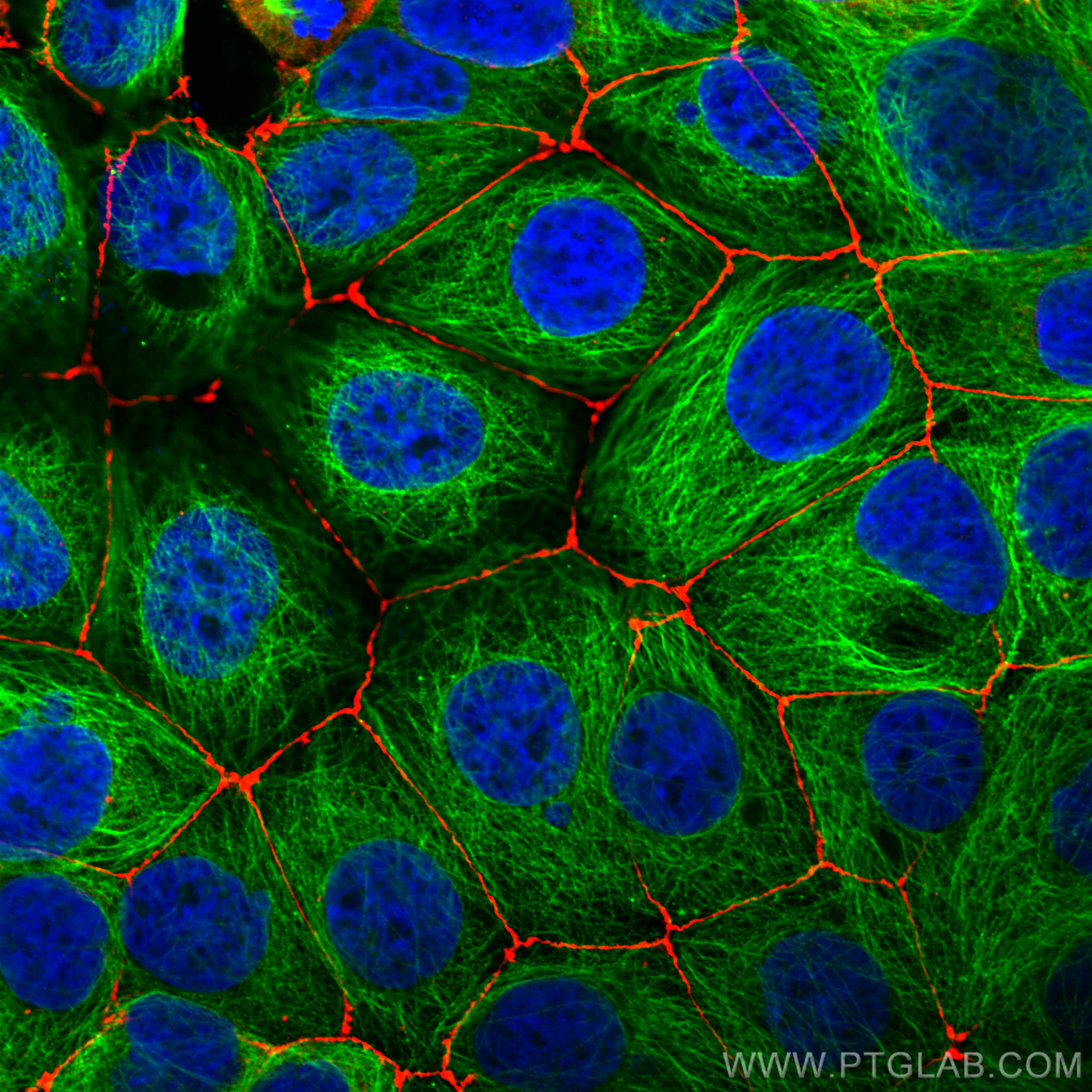 IF Staining of MCF-7 using 66031-1-Ig (same clone as 66031-1-PBS)