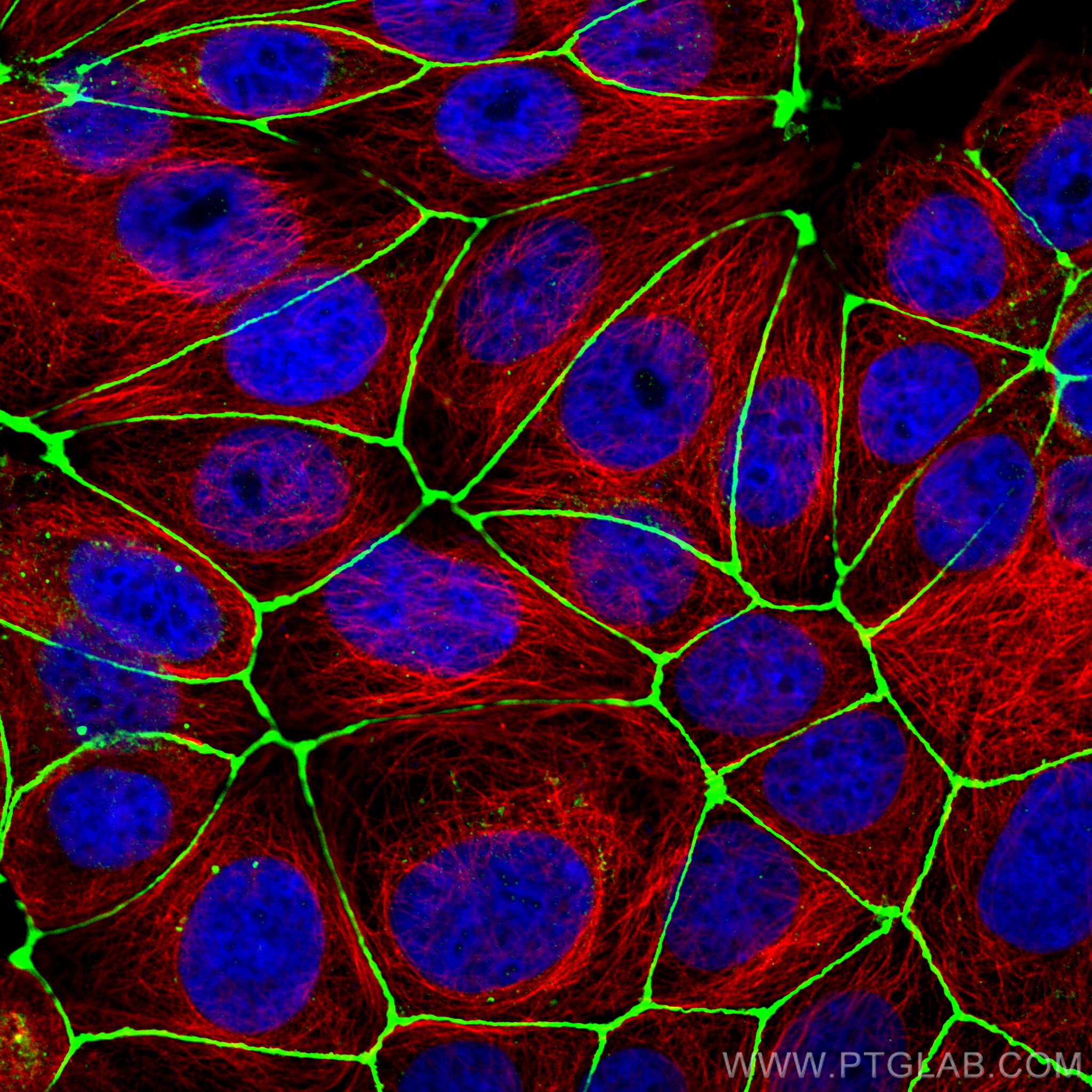 IF Staining of MCF-7 using 66031-1-Ig (same clone as 66031-1-PBS)