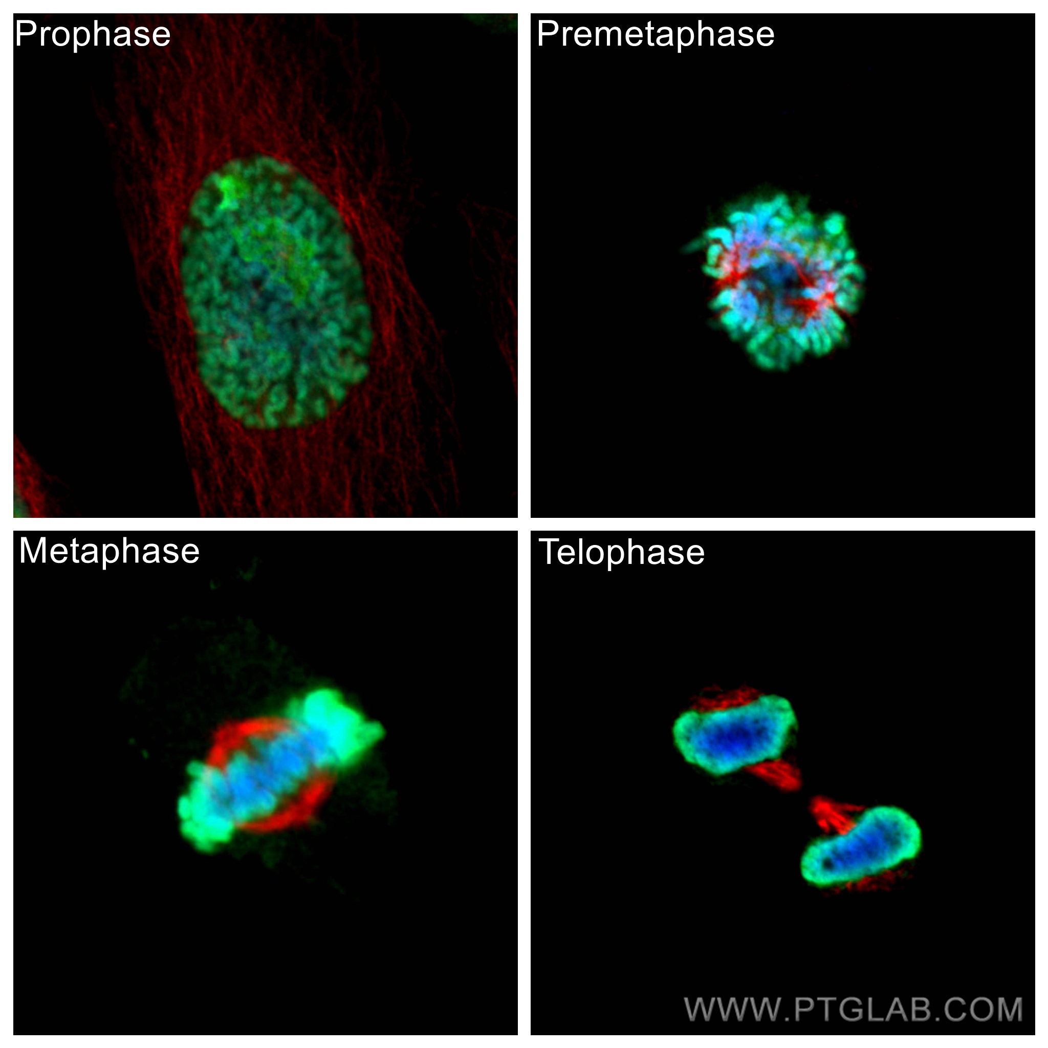 IF Staining of HeLa using 66031-1-Ig (same clone as 66031-1-PBS)